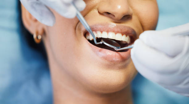 Best Emergency Treatment for Oral Infections in Parkwood, WA