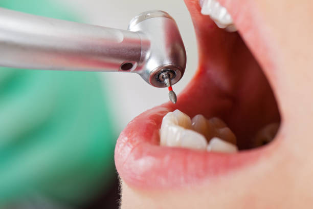 Best Walk-In Emergency Dental Services in Parkwood, WA